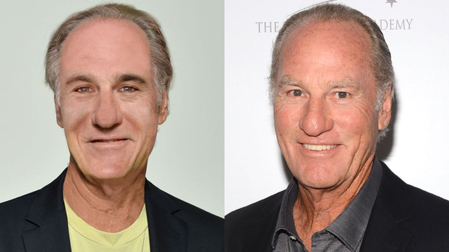 Illustration for article titled This ‘The District’ Fan Spent $100,000 On Plastic Surgery To Look Just Like Craig T. Nelson